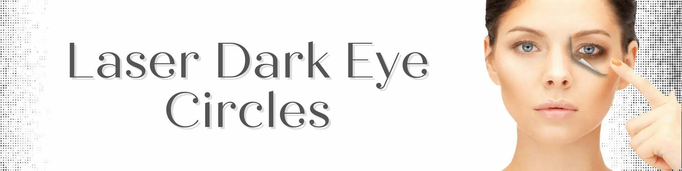 Laser Dark Eye Circles